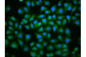 Immunofluorescence staining of Hela cells with ABIN7174438 at 1:100, counter-stained with DAPI. (UBE2D2 Antikörper  (AA 1-147))