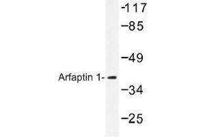 Image no. 1 for anti-ADP-Ribosylation Factor Interacting Protein 1 (ARFIP1) antibody (ABIN317818) (ARFIP1 Antikörper)