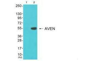 Western blot analysis of extracts from 3T3 cells (Lane 2), using COX17 antiobdy. (COX17 Antikörper  (N-Term))
