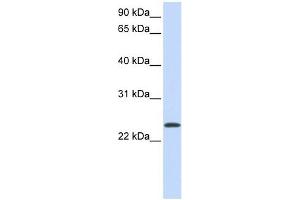 ARF1 antibody used at 1 ug/ml to detect target protein. (ARF1 Antikörper  (Middle Region))
