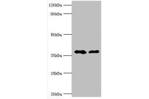 Western blot All lanes: Methylglutaconyl-CoA hydratase, mitochondrial antibody at 6 μg/mL Lane 1: Rat brain tissue Lane 2: Rat kidney tissue Secondary Goat polyclonal to rabbit IgG at 1/10000 dilution Predicted band size: 36, 33 kDa Observed band size: 36 kDa (AUH Antikörper  (AA 68-339))