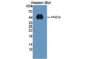 Detection of recombinant ADAMTS10 using Polyclonal Antibody to A Disintegrin And Metalloproteinase With Thrombospondin 10 (ADAMTS10) (ADAMTS10 Antikörper  (AA 239-602))
