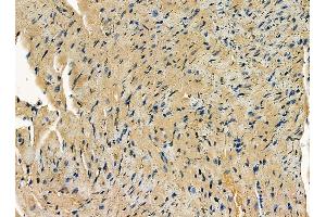ABIN7095318 and ABIN7099375 at 1/100 staining mouse heart tissue by IHC-P. (SNX33 Antikörper)