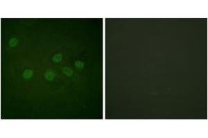 Immunofluorescence analysis of HeLa cells, using CBP (Ab-1535) Antibody. (CBP Antikörper  (AA 1501-1550))