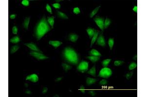 Immunofluorescence (IF) image for anti-Guanine Nucleotide Binding Protein (G Protein), beta Polypeptide 3 (GNB3) (AA 1-340) antibody (ABIN561073)