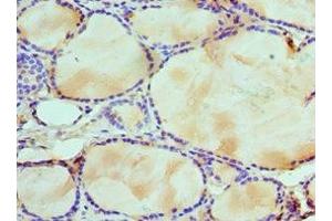 Immunohistochemistry of paraffin-embedded human thyroid tissue using ABIN7175761 at dilution of 1:100 (WDR5 Antikörper  (AA 1-334))