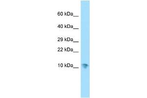 WB Suggested Anti-SERF1A Antibody Titration: 1. (SERF1A Antikörper  (N-Term))
