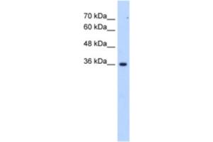Western Blotting (WB) image for anti-Asparagine-Linked Glycosylation 1 Homolog Pseudogene (ALG1L6P) antibody (ABIN2463268) (ALG1L6P Antikörper)