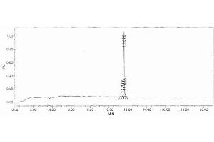 Image no. 2 for Procollagen III N-Terminal Propeptide (PIIINP) (N-Term) peptide (Ovalbumin) (ABIN5666354) (Procollagen III N-Terminal Propeptide (PIIINP) (N-Term) peptide (Ovalbumin))