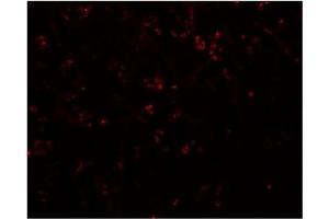 Immunofluorescence of SYNPO in human brain tissue with SYNPO Antibody  at 20 μg/ml.