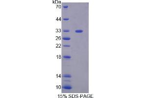 Image no. 1 for phosphoglycerate Mutase 1 (Brain) (PGAM1) (AA 2-254) protein (His tag) (ABIN6237350) (PGAM1 Protein (AA 2-254) (His tag))