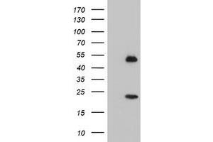 Western Blotting (WB) image for anti-Nucleobindin 1 (NUCB1) antibody (ABIN1499847)