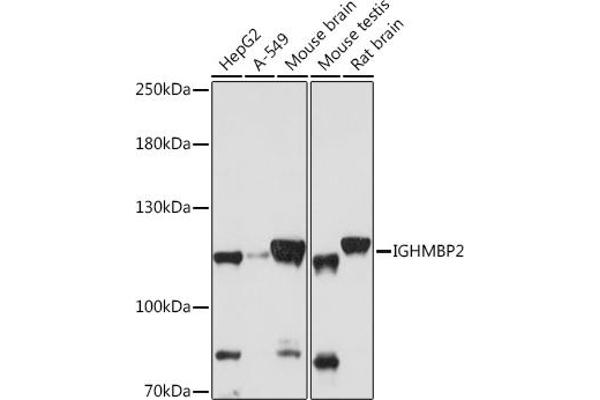 IGHMBP2 Antikörper  (AA 540-720)
