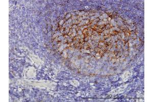 Immunoperoxidase of monoclonal antibody to QPRT on formalin-fixed paraffin-embedded human tonsil. (QPRT Antikörper  (AA 198-297))