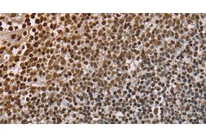 Immunohistochemistry of paraffin-embedded Human tonsil using NUP50 Polyclonal Antibody at dilution of 1:30 (NUP50 Antikörper)