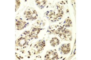 Immunohistochemistry of paraffin-embedded Human mammary gland using PRPF3 antibody at dilution of 1:100 (x400 lens). (PRPF3 Antikörper)