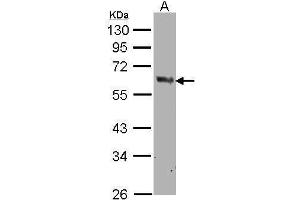 WB Image Sample(30 μg of whole cell lysate) A:MOLT4, 10% SDS PAGE antibody diluted at 1:500 (PTGS1 Antikörper  (C-Term))