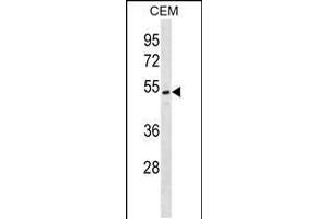 Western blot analysis in CEM cell line lysates (35ug/lane). (ONECUT2 Antikörper  (N-Term))