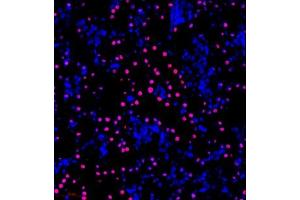 Immunofluorescence of paraffin embedded rat kidney using NPEPL1 (ABIN7073185) at dilution of 1:200 (300x lens) (BIVM Antikörper)