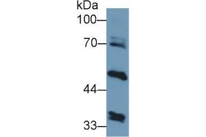 Detection of ALT2 in Human Liver lysate using Polyclonal Antibody to Alanine Aminotransferase 2 (ALT2) (GPT2 Antikörper  (AA 210-300))