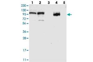 Western blot analysis of Lane 1: RT-4, Lane 2: U-251 MG, Lane 3: Human Plasma, Lane 4: Liver, Lane 5: Tonsil with RBM28 polyclonal antibody . (RBM28 Antikörper)