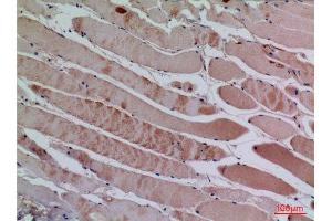 Immunohistochemistry (IHC) analysis of paraffin-embedded Human Muscle, antibody was diluted at 1:100. (CXCL13 Antikörper  (Internal Region))