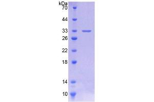 SDS-PAGE (SDS) image for Cytochrome P450, Family 11, Subfamily A, Polypeptide 1 (CYP11A1) (AA 44-287) protein (His tag) (ABIN6238648)