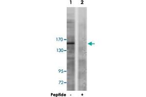 Western blot analysis of extracts from A-549 cells, using TP53BP1 polyclonal antibody . (TP53BP1 Antikörper)