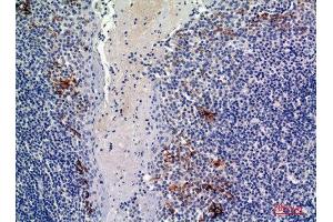Immunohistochemistry (IHC) analysis of paraffin-embedded Human Tonsils, antibody was diluted at 1:100.