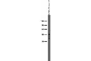 anti-RNA Binding Motif Protein 17 (RBM17) (AA 100-200) antibody