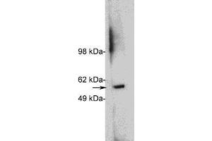 Western blot using  X1879P, rabbit polyclonal at 1 ug/ml on HeLa cell extract (20 ug/lane). (HDAC1 Antikörper)