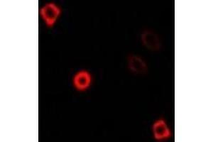 Immunofluorescent analysis of KIF3A staining in U2OS cells. (KIF3A Antikörper)