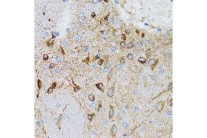 Immunohistochemistry (Paraffin-embedded Sections) (IHC (p)) image for anti-Progesterone Receptor Membrane Component 1 (PGRMC1) (AA 44-195) antibody (ABIN6145520)