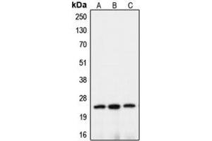 Western blot analysis of Claudin 10 expression in HEK293T (A), mouse brain (B), rat kidney (C) whole cell lysates. (CLDN10 Antikörper  (C-Term))