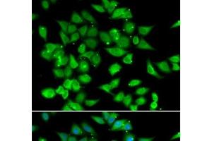 Immunofluorescence analysis of HeLa cells using NFATC3 Polyclonal Antibody (NFATC3 Antikörper)