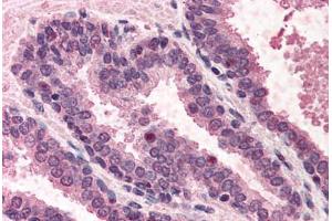 Human Prostate (formalin-fixed, paraffin-embedded) stained with POLK antibody ABIN291099 at 5 ug/ml followed by biotinylated anti-goat IgG secondary antibody ABIN481715, alkaline phosphatase-streptavidin and chromogen. (POLK Antikörper  (AA 817-830))