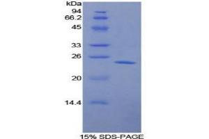 SDS-PAGE analysis of Human LMP7 Protein. (PSMB8 Protein)