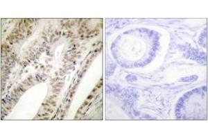 Immunohistochemistry analysis of paraffin-embedded human tonsil tissue, using PML Antibody. (PML Antikörper  (AA 11-60))