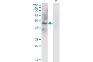 Western Blot analysis of LAMP2 expression in transfected 293T cell line by LAMP2 monoclonal antibody (M01), clone 2G10. (LAMP2 Antikörper  (AA 30-127))