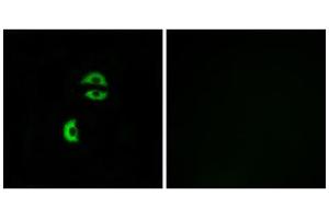 Immunofluorescence analysis of A549 cells, using LDLRAD3 antibody. (LDLRAD3 Antikörper  (Internal Region))