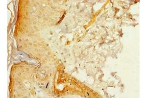 Immunohistochemistry of paraffin-embedded human skin tissue using ABIN7175005 at dilution of 1:100 (MRPL46 Antikörper  (AA 28-153))