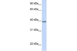 Tetraspanin 10 antibody used at 1 ug/ml to detect target protein. (TSPAN10 Antikörper  (N-Term))
