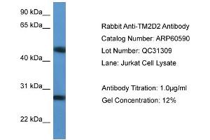 WB Suggested Anti-TM2D2  Antibody Titration: 0. (TM2D2 Antikörper  (Middle Region))