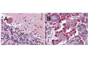 anti-LGR4 monoclonal antibody was used diluted to 5 ? (LGR4 Antikörper  (Internal Region))