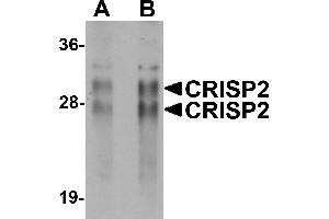 Western Blotting (WB) image for anti-Cysteine-Rich Secretory Protein 2 (CRISP2) (N-Term) antibody (ABIN1031327)