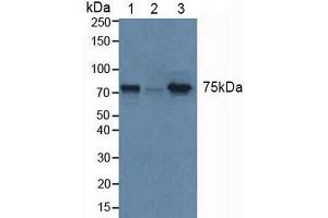 Western blot analysis of (1) Human Liver Tissue, (2) Human HeLa cells and (3) Mouse Uterus Tissue. (GBA Antikörper  (AA 117-214))