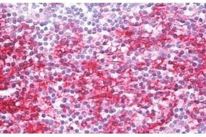 Human Tonsil: Formalin-Fixed, Paraffin-Embedded (FFPE) (CD40 Antikörper)