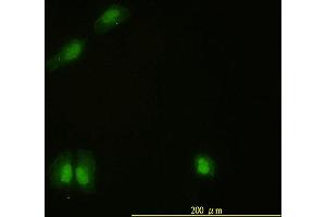 Immunofluorescence of monoclonal antibody to CAMK4 on HeLa cell. (CAMK4 Antikörper  (AA 1-473))