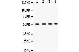 Western Blotting (WB) image for anti-Gap Junction Protein, alpha 3, 46kDa (GJA3) (AA 89-118), (N-Term) antibody (ABIN3042423)