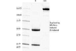SDS-PAGE Analysis Purified Adipophilin Mouse Monoclonal Antibody (ADFP/1494). (ADRP Antikörper  (AA 249-376))
